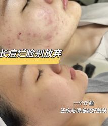 -Cream88颜皮肤管理中心