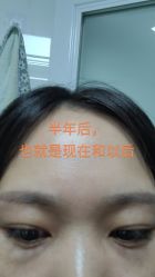 体验前-Yestar重庆艺星医疗美容医院
