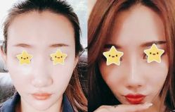 点击看大图 -SKINIST丽铂医疗美容