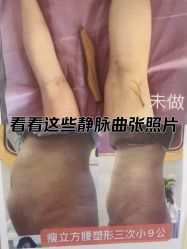 -瘦立方身材管理中心