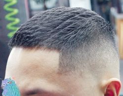 -大麦微针植发丨全国连锁