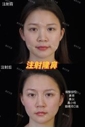 -Yestar重庆艺星医疗美容医院
