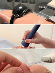 -韩国淼美颜皮肤管理官方直营店