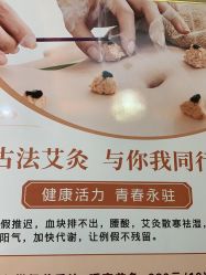 -悦艾堂·中医拔罐减肥·美体艾灸连锁