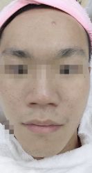 点击看大图 -痘博士广州·全国连锁祛痘机构