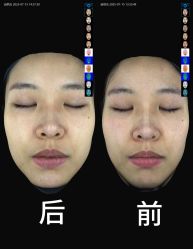 -AURAS璈然科技护肤中心