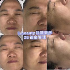 -E.beauty驻颜·痘敏肌调理中心