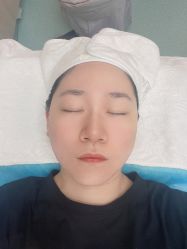 体验后-JS医疗美容