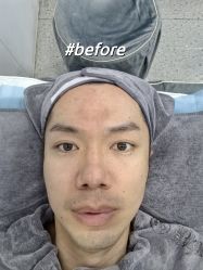 -北京豆豆博士专业祛痘