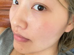 点击看大图 体验前-天津伊美尔医疗整形美容专科医院