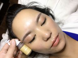 点击看大图 -郡艺医疗美容·微整·眼鼻吸脂