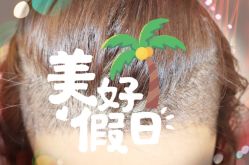 -大麦微针植发全国连锁