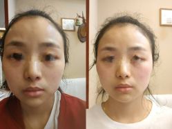 -颜和骨正·明哲式骨相美学整骨