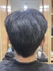 -雍禾植发