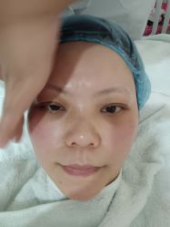 体验前-郡艺医疗美容·微整·眼鼻吸脂