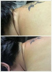 -奈瑞儿美颜塑身SPA