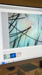 -史云逊养发护发