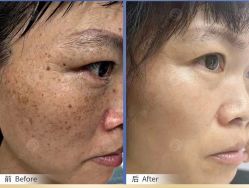 -美肤盾祛痘·问题肌头疗管理中心