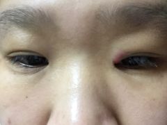 -天津市黄河医院