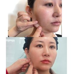 -黎蓓露·徒手骨雕蛋白抗衰·调肤管理