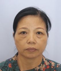 -天津健丽·去眼袋医疗美容机构