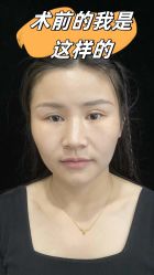 -素美医疗美容·西南眼鼻整形·修复基地