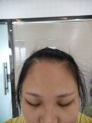 -莲姿娜·半永久纹眉皮肤管理