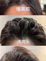 -IP SALON