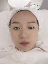体验后-康美贞·痘肌养护管理中心