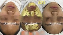 -SKIN79皮肤管理中心