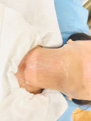 体验前-新美荟医美·专注面部美学抗衰