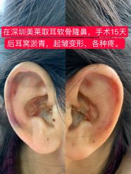 -深圳美莱医疗美容医院