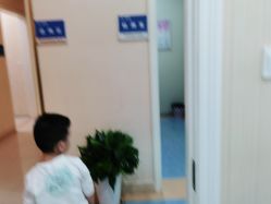 -碧莲盛·不剃发植发