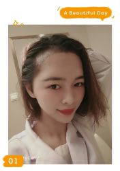 -大麦微针植发全国连锁