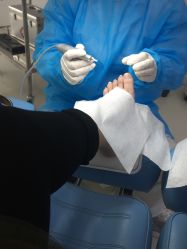 -派恩宜灰指甲鸡眼嵌甲手足癣