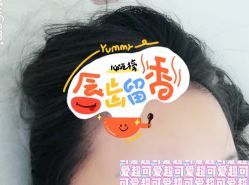 -大麦微针植发全国连锁