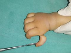 -华中科技大学同济医学院附属协和医院(主院区)