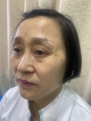 体验前-重庆联合丽格第五医疗美容医院