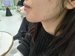 -Yestar艺星整形美容医院