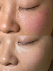 点击看大图 -蘭FACE·海菲秀飞顿Med SPA