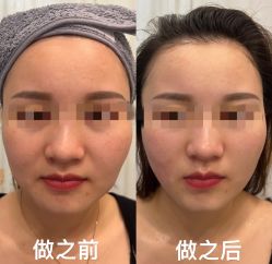 -瓷肌博士·祛痘科技美肤