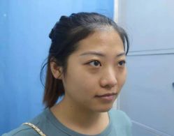 -天津健丽·去眼袋医疗美容机构
