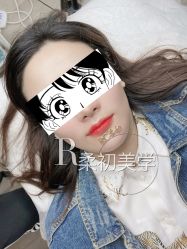 -RC半永久纹眉纹发际线