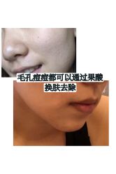 -八大处整形