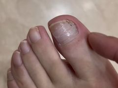 -新甲连锁灰指甲·甲沟炎·鸡眼(黑龙江路店)