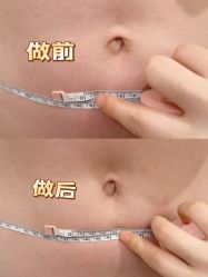 -Fundi张玉珊修身堂·indiba·BTL科技瘦身