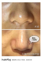 脸部抗衰-光SPA科技美肤