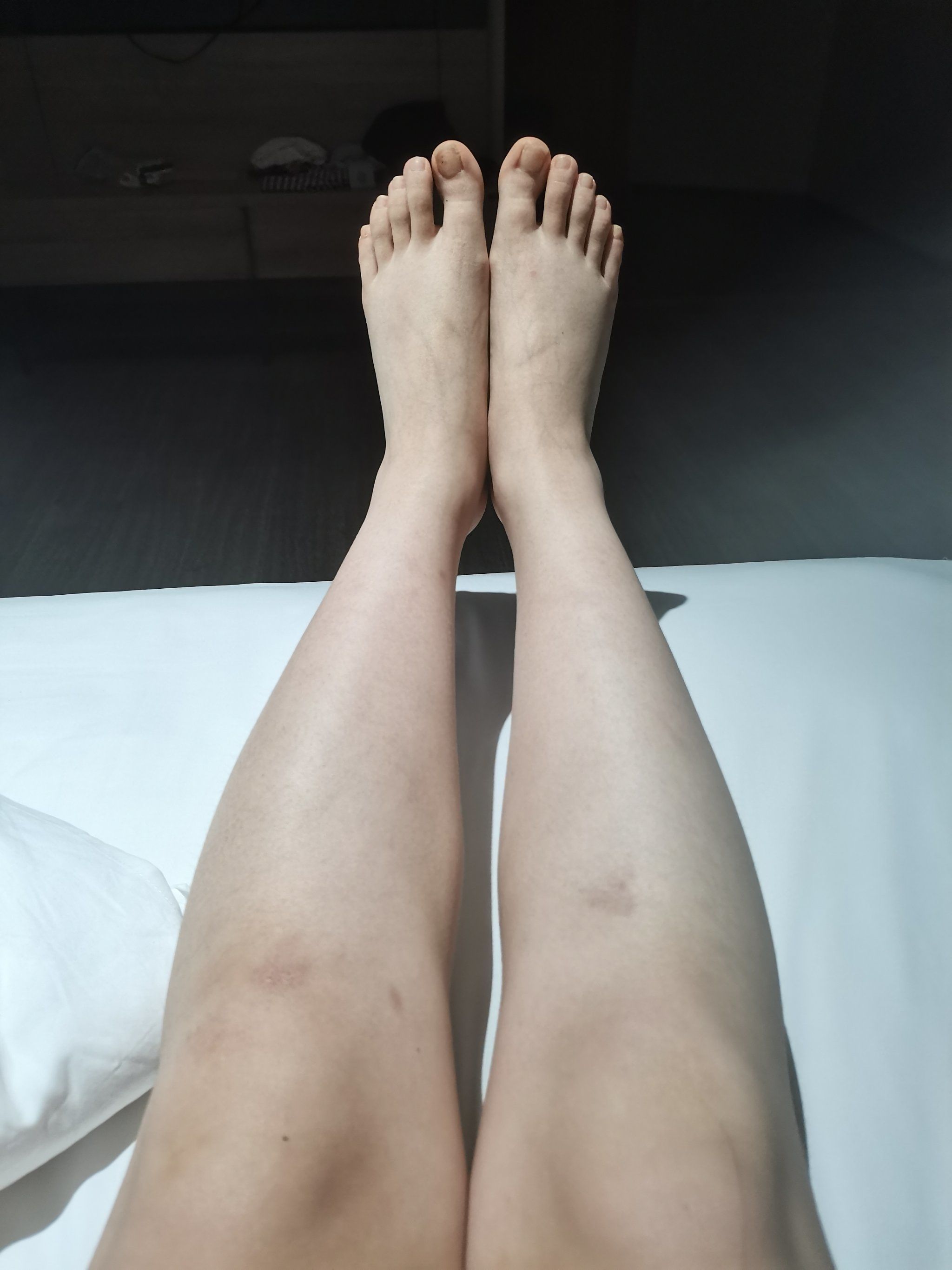 0元玩转这座城 一到晚上水肿得特别厉