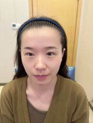 -大麦微针植发全国连锁