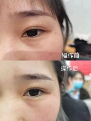 点击看大图 -苑苑vbeauty科技美容SPA